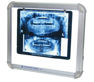 LED X-RAY VIEWER